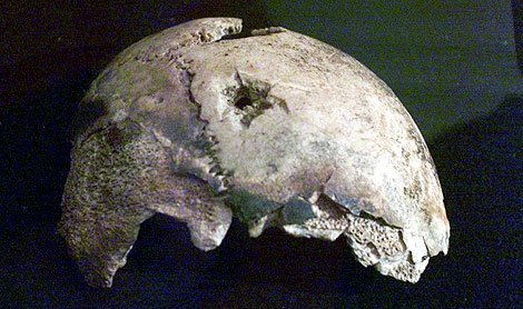 El cráneo con el impacto de bala que se decía pertenecía a Hitler y se concluyó por investigadores estadounidenses que debía pertenecer a una mujer