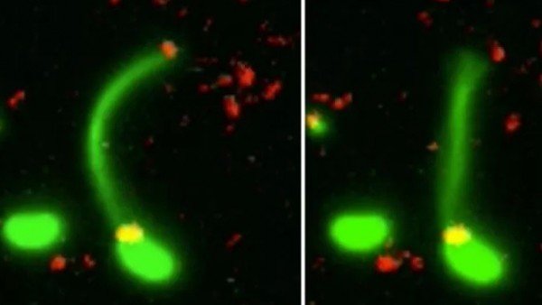 Obtienen Por Primera Vez La Imagen En La Que Una Bacteria Deriva En Superbacteria, Planeta Incógnito