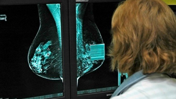 Investigación sobre el cáncer de mama