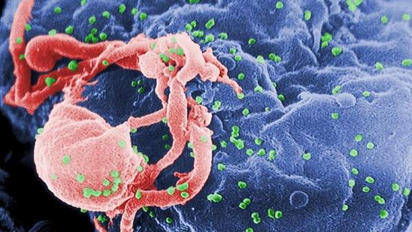 virus del sida, VIH